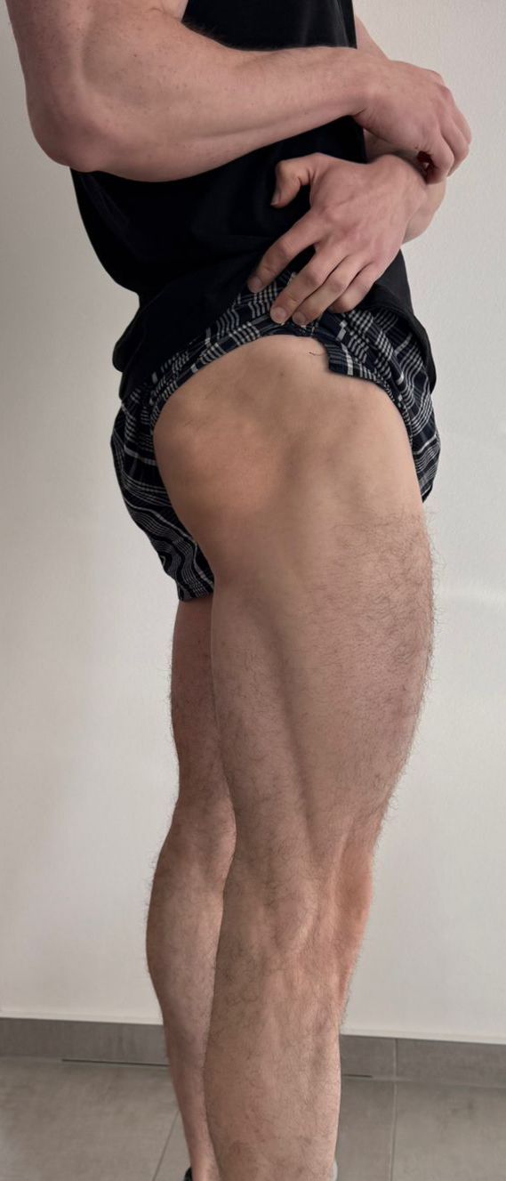 trenLegs.jpeg